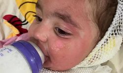 Adana'daki kreşte çocuğun üzerine kahve döküldü
