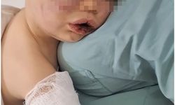 Denizli’de darp sonucu hastanelik olan bebek devlet korumasına alınacak