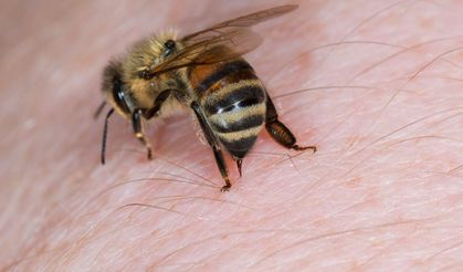 Bingöl’de arıların soktuğu kişi öldü
