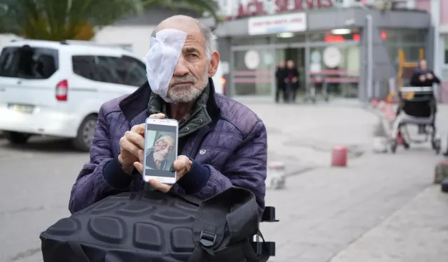 Türkiye'de ilk vakıa: 'Yüzü eriyen' adam tedavi olmak istiyor: 'Gözüm akıyor'