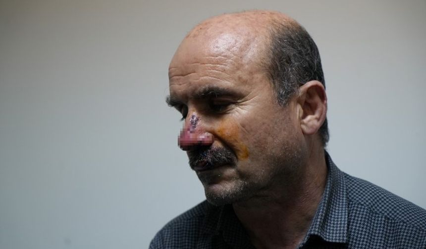 Muş’ta köpek saldırısı: Bir vatandaşın ağzı ve burnu parçalandı