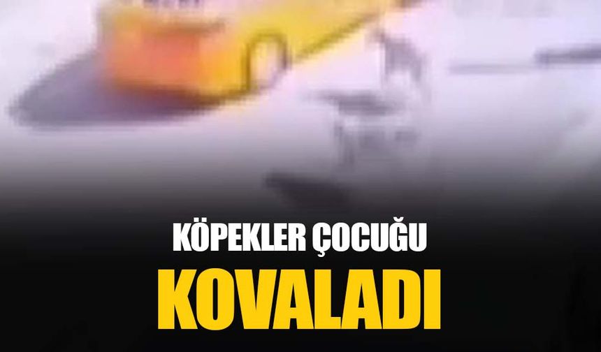 Ankara Mamak'ta sokak köpekleri çocuğa saldırdı: Kaval kemiği kırıldı